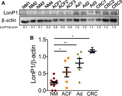 LonP1 Differently Modulates Mitochondrial Function and Bioenergetics of Primary Versus Metastatic Colon Cancer Cells